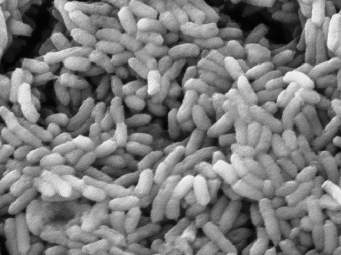 キユーピーと酢酸菌 研究開発 キユーピー キユーピーと酢酸菌 研究開発 キユーピー