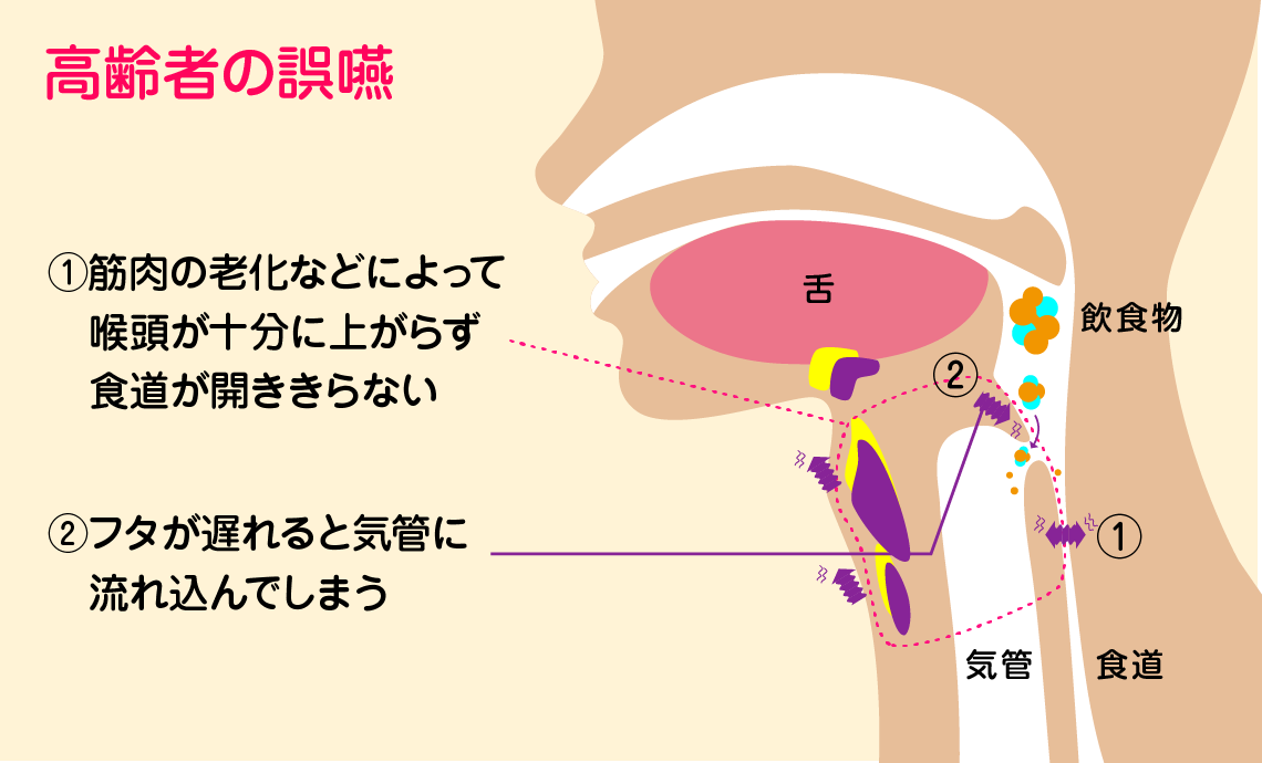 最近むせやすいのはなぜ 食育活動 キユーピー