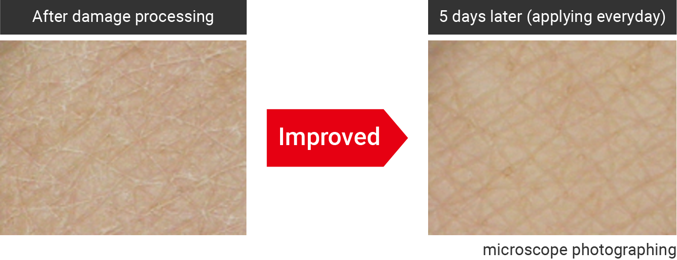 Improvement of damaged skin