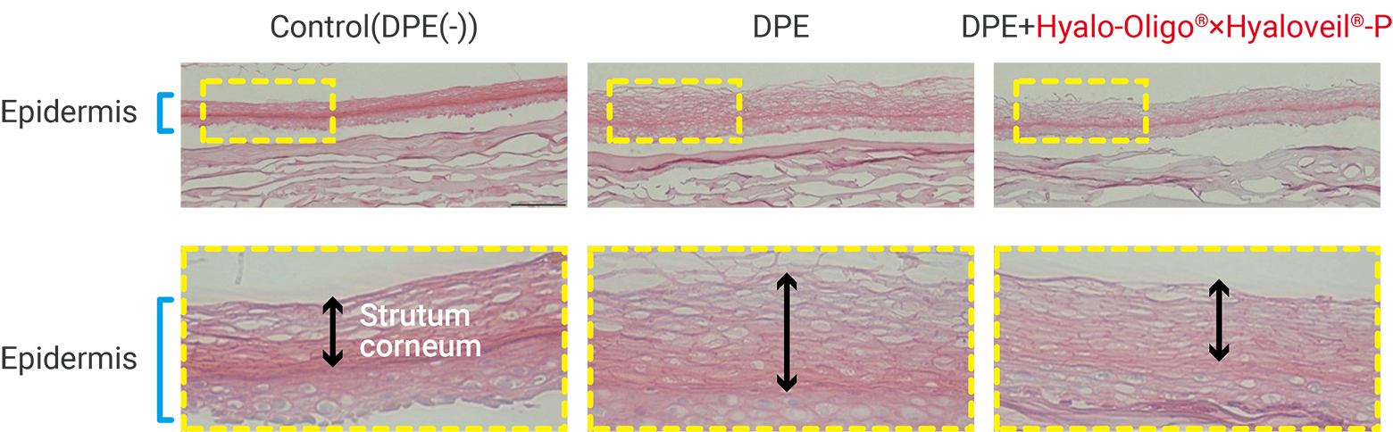 If hyperkeratosis occurs, the skin becomes stiff and the skin texture gets rough.