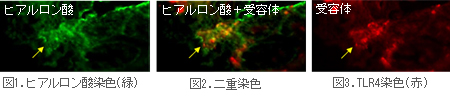 図1．ヒアルロン酸染色（緑） 図2．二重染色 図3.TLR4染色（赤）