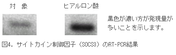 図4.サイトカイン制御因子(SOCS3)のRT-PCR結果